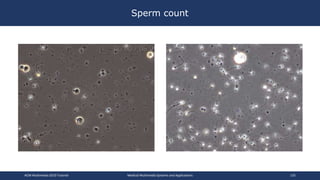 Sperm count
ACM Multimedia 2019 Tutorial Medical Multimedia Systems and Applications 135
 