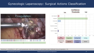 Gynecologic Laparoscopy: Surgical Actions Classification
ACM Multimedia 2019 Tutorial Medical Multimedia Systems and Appli...