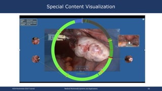 Special Content Visualization
ACM Multimedia 2019 Tutorial Medical Multimedia Systems and Applications 58
 