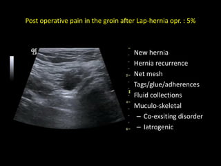 Post operative pain in the groin after Lap-hernia opr. : 5%
• New hernia
• Hernia recurrence
• Net mesh
• Tags/glue/adherences
• Fluid collections
• Muculo-skeletal
– Co-exsiting disorder
– Iatrogenic
 
