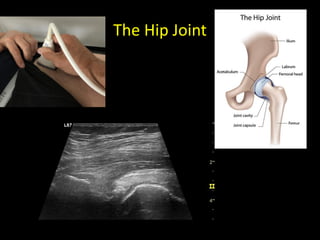 The Hip Joint
 