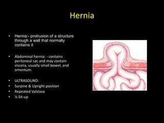 Hernia
• Hernia:- protrusion of a structure
through a wall that normally
contains it
• Abdominal hernia: - contains
peritoneal sac and may contain
viscera, usually small bowel, and
omentum.
• ULTRASOUND:
• Surpine & Upright position
• Repeated Valslava
• ½ Sit-up
 