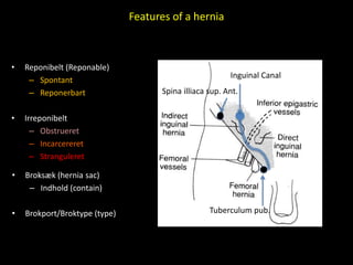 Features of a hernia
• Reponibelt (Reponable)
– Spontant
– Reponerbart
• Irreponibelt
– Obstrueret
– Incarcereret
– Stranguleret
• Broksæk (hernia sac)
– Indhold (contain)
• Brokport/Broktype (type)
Spina illiaca sup. Ant.
Tuberculum pub.
Inguinal Canal
 