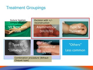 Treatment Groupings
VII Type with
stalk
Asymmetrical
(VII/II/III)
Type IV
“typical”
Type IV
“convergent”
“Small”
symmetrical
(II/III)
“Others”
Less common
Excision with +/-
reconstruction
Combination procedure (Bilhaut-
Cloquet type)
Suture ligation
Simple excision
 