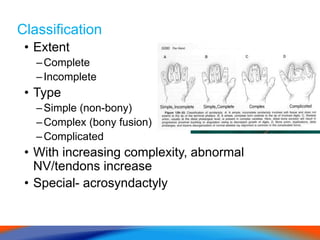 Classification
• Extent
–Complete
–Incomplete
• Type
–Simple (non-bony)
–Complex (bony fusion)
–Complicated
• With increasing complexity, abnormal
NV/tendons increase
• Special- acrosyndactyly
 