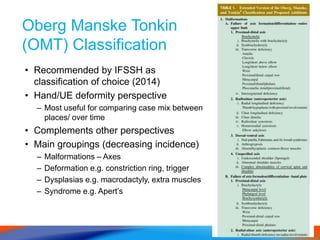 Oberg Manske Tonkin
(OMT) Classification
• Recommended by IFSSH as
classification of choice (2014)
• Hand/UE deformity perspective
– Most useful for comparing case mix between
places/ over time
• Complements other perspectives
• Main groupings (decreasing incidence)
– Malformations – Axes
– Deformation e.g. constriction ring, trigger
– Dysplasias e.g. macrodactyly, extra muscles
– Syndrome e.g. Apert’s
 