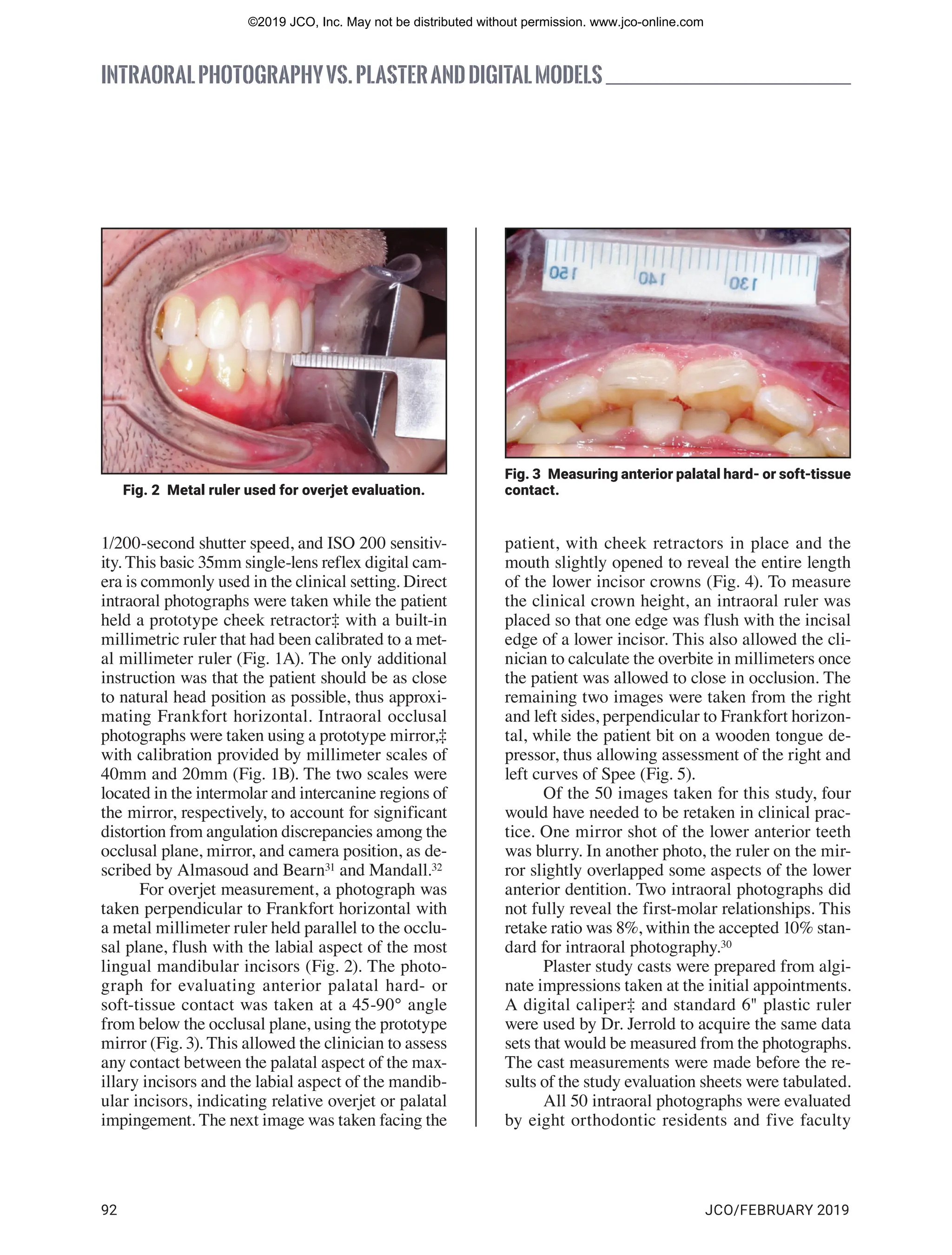 Can Intraoral Photography Replace Plaster and Digital Models in ...