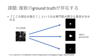 n}: }ground truthڤ
? βλȤΤόTҽgǤҊ֤

ΤCT
}
ground truth
S. A. A. Kohl et al., A Probabilistic U-Net for Segmentation of Ambiguous Images, NeurIPS (2018)
 