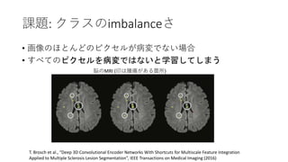 n}: 饹imbalance
? ΤۤȤɤΥԥ뤬Ǥʤ
? ٤ƤΥԥ򲡉ǤϤʤѧƤޤ
×MRI (ӡ[w)
T. Brosch et al., Deep 3D Convolutional Encoder Networks With Shortcuts for Multiscale Feature Integration
Applied to Multiple Sclerosis Lesion Segmentation, IEEE Transactions on Medical Imaging (2016)
 