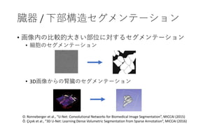 Ġ / ²쥻Ʃ`
? ڤα^Ĵ󤭤λˌ륻Ʃ`
? ΥƩ`
? 3D񤫤IĠΥƩ`
O. Ronneberger et al., U-Net: Convolutional Networks for Biomedical Image Segmentation, MICCAI (2015)
?. ?i?ek et al., 3D U-Net: Learning Dense Volumetric Segmentation from Sparse Annotation, MICCAI (2016)
 