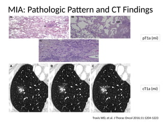 Comprehensive High-Resolution CT Imaging and Classification of Lung ...
