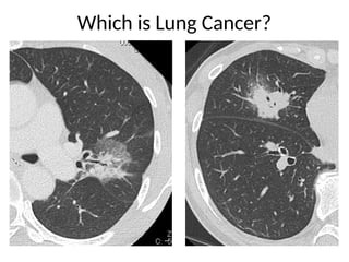 Comprehensive High-Resolution CT Imaging and Classification of Lung ...