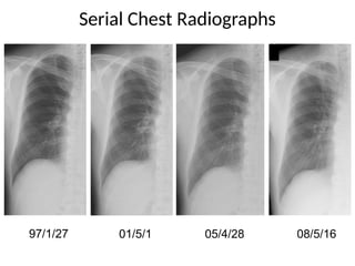 Comprehensive High-Resolution CT Imaging and Classification of Lung ...
