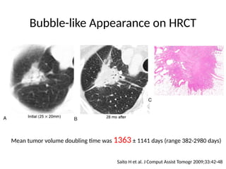 Comprehensive High-Resolution CT Imaging and Classification of Lung ...