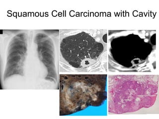 Comprehensive High-Resolution CT Imaging and Classification of Lung ...
