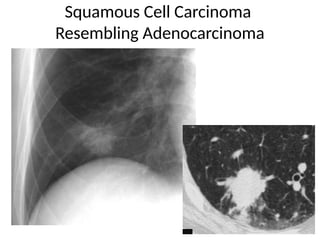 Comprehensive High-Resolution CT Imaging and Classification of Lung ...