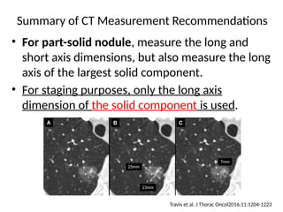 Comprehensive High-Resolution CT Imaging and Classification of Lung ...
