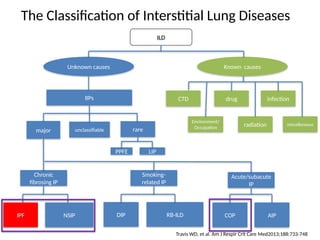 Nsip Classification Comprehensive High-Resolution CT Evaluation of Diffuse Lung Diseases ...
