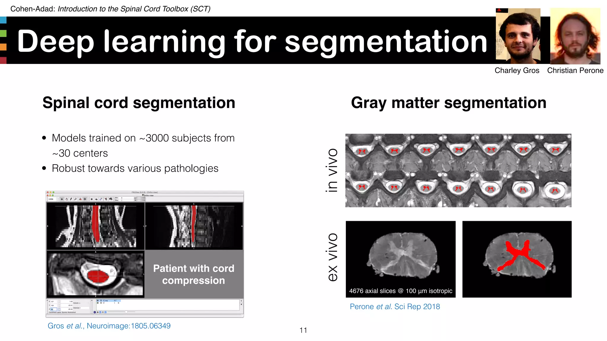 Cohen-Adad: Introduction to the Spinal Cord Toolbox (SCT)
Deep learning for segmentation
11
Spinal cord segmentation
• Models trained on ~3000 subjects from
~30 centers
• Robust towards various pathologies
Charley Gros
Patient with cord
compression
Gros et al., Neuroimage:1805.06349
invivoexvivo
Perone et al. Sci Rep 2018
Gray matter segmentation
Christian Perone
4676 axial slices @ 100 μm isotropic
 