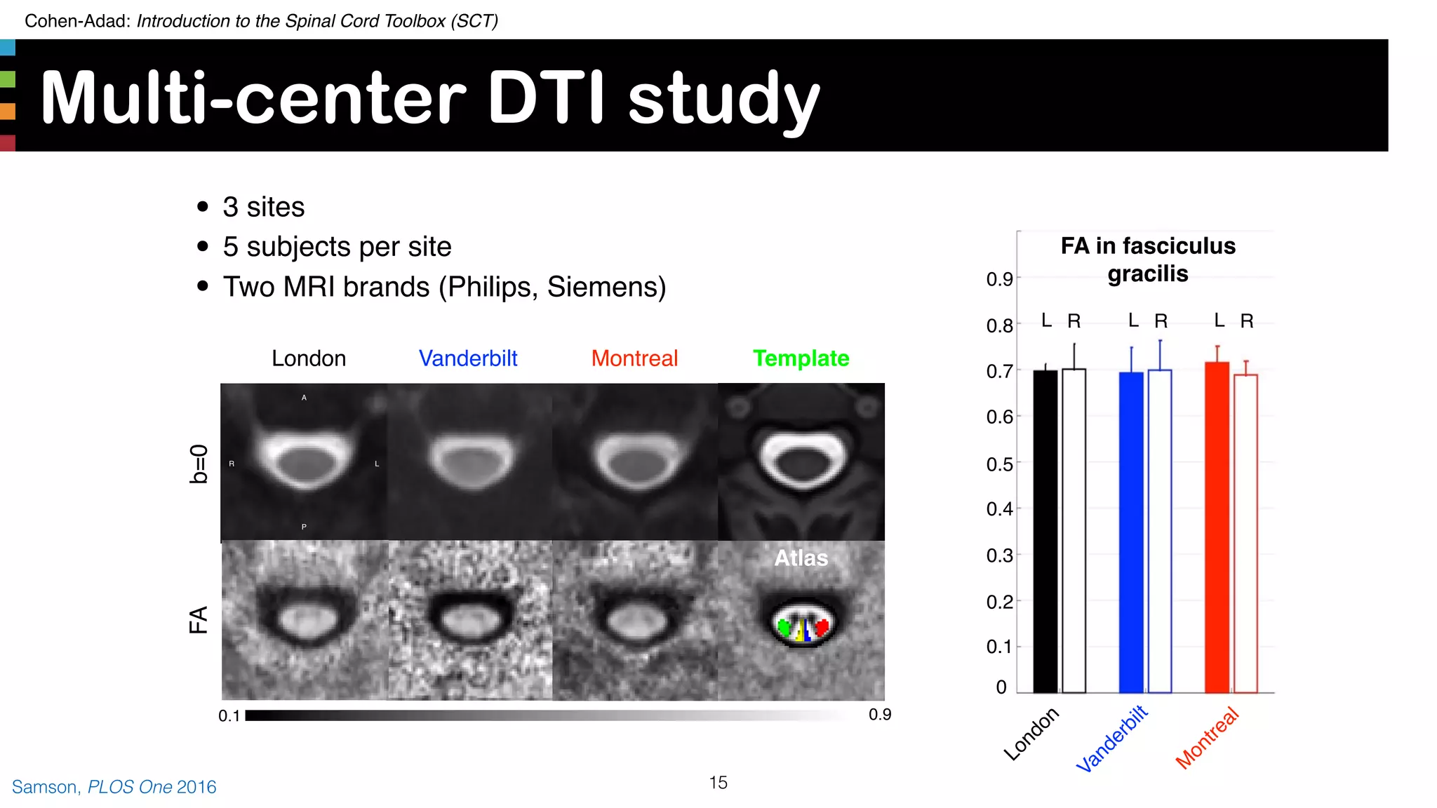 Cohen-Adad: Introduction to the Spinal Cord Toolbox (SCT)
Multi-center DTI study
15Samson, PLOS One 2016
Vanderbilt MontrealLondon
A
P
R
b=0FA
0.1 0.9
L
Template
Atlas
London
Vanderbilt
M
ontreal
FA in fasciculus
gracilis
0
0.1
0.2
0.3
0.4
0.5
0.6
0.7
0.8
0.9
L R L R L R
• 3 sites
• 5 subjects per site
• Two MRI brands (Philips, Siemens)
 