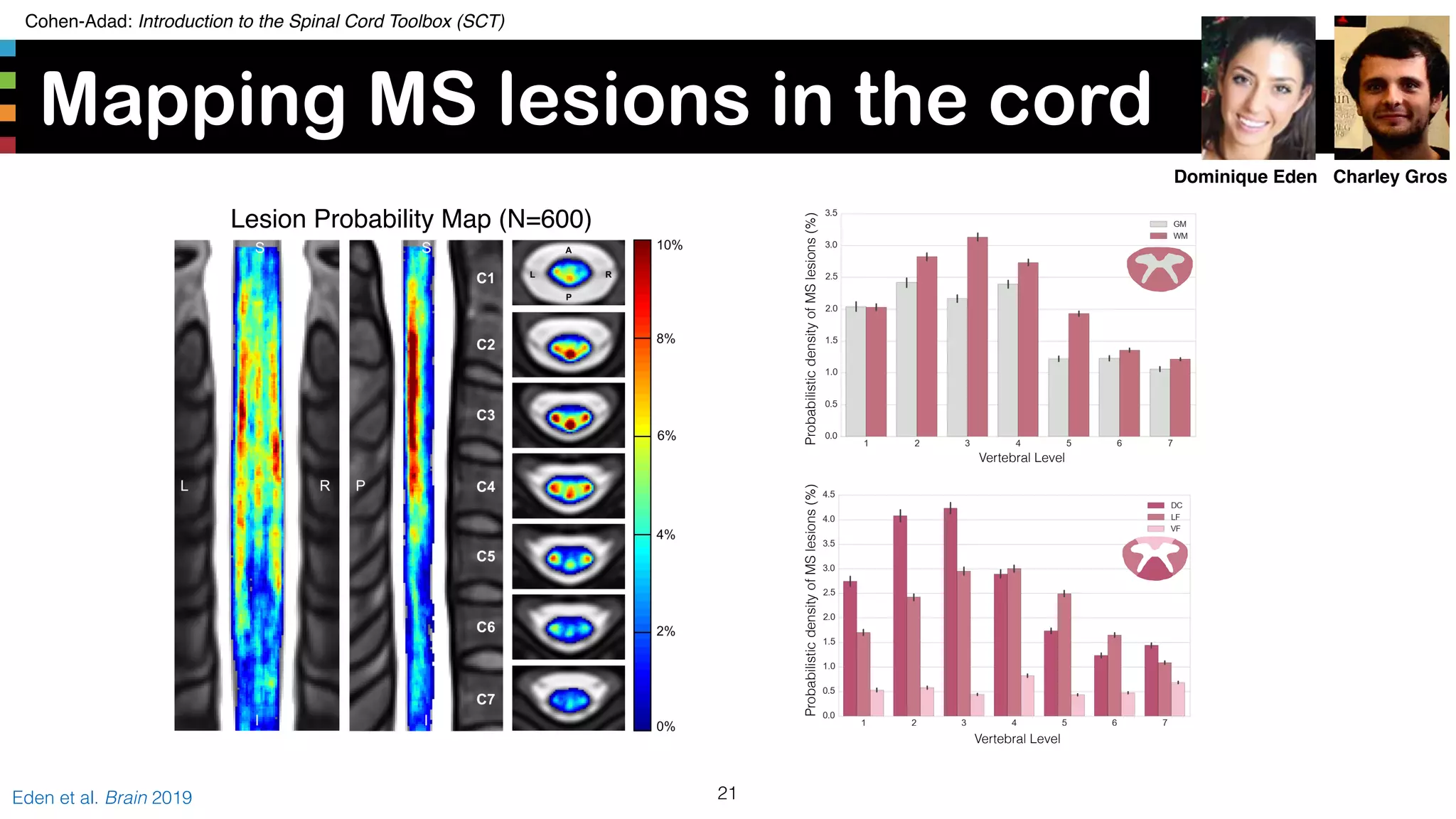 Cohen-Adad: Introduction to the Spinal Cord Toolbox (SCT)
ProbabilisticdensityofMSlesions(%)
Vertebral Level
Mapping MS lesions in the cord
21Eden et al. Brain 2019
Vertebral Level
ProbabilisticdensityofMSlesions(%)
Lesion Probability Map (N=600)
Charley GrosDominique Eden
 