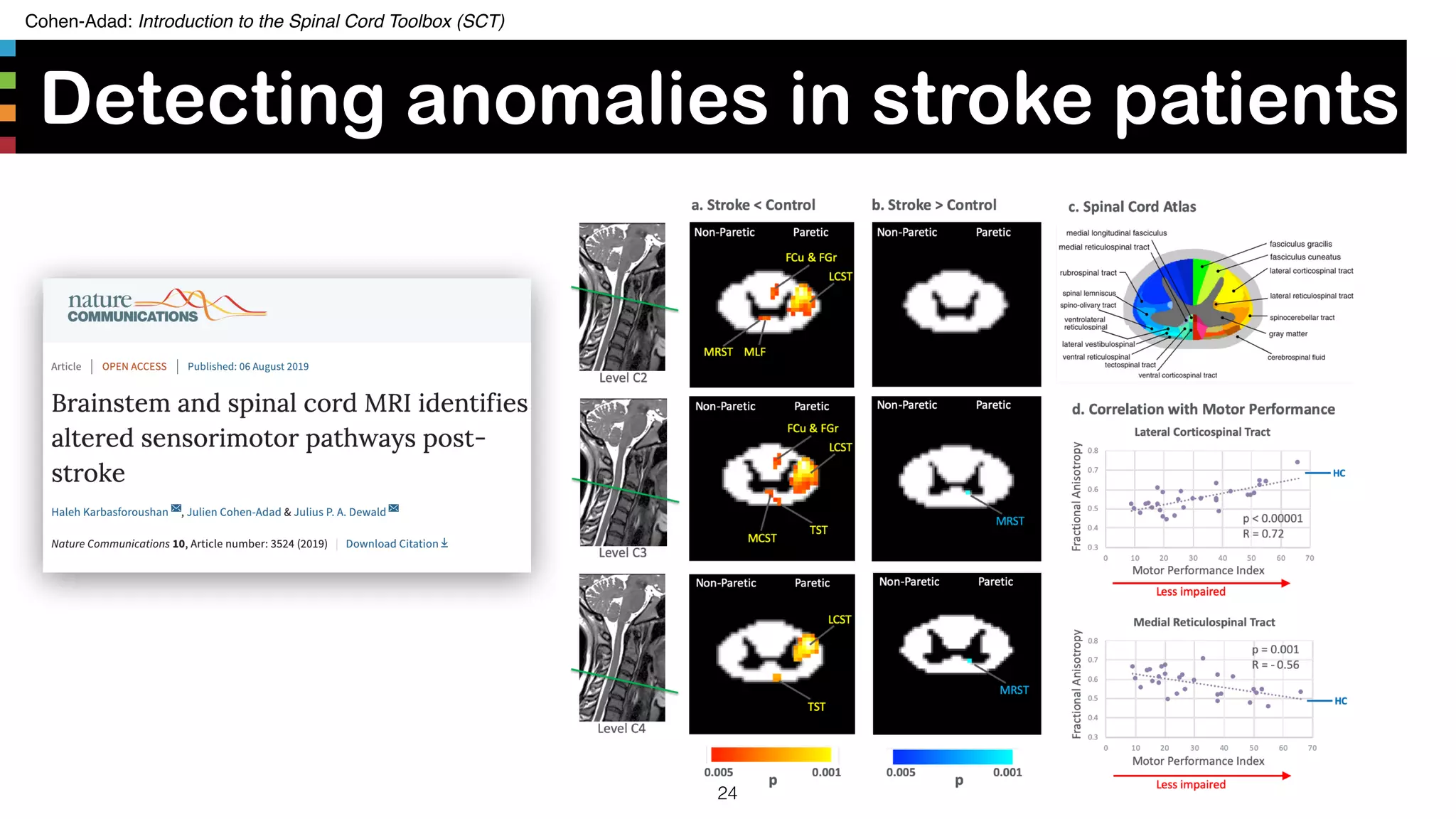 Cohen-Adad: Introduction to the Spinal Cord Toolbox (SCT)
Detecting anomalies in stroke patients
24
 
