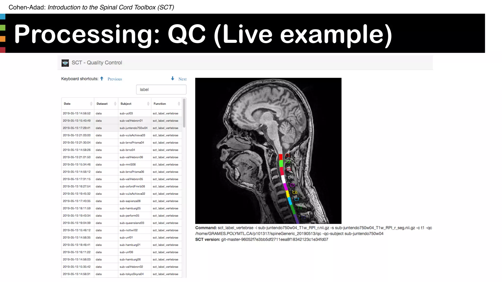 Cohen-Adad: Introduction to the Spinal Cord Toolbox (SCT)
Processing: QC (Live example)
34
 