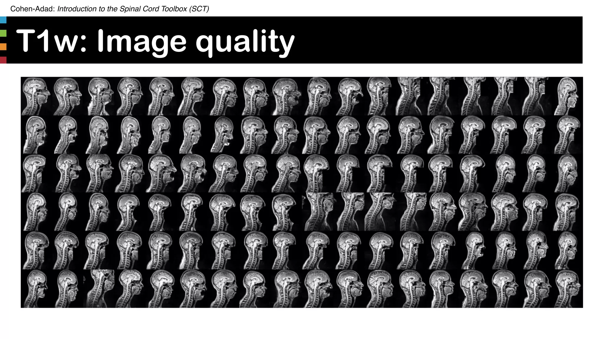 Cohen-Adad: Introduction to the Spinal Cord Toolbox (SCT)
T1w: Image quality
37
 