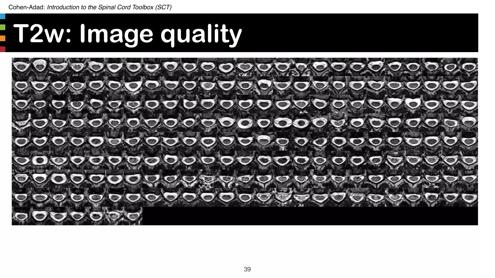 Cohen-Adad: Introduction to the Spinal Cord Toolbox (SCT)
T2w: Image quality
39
 