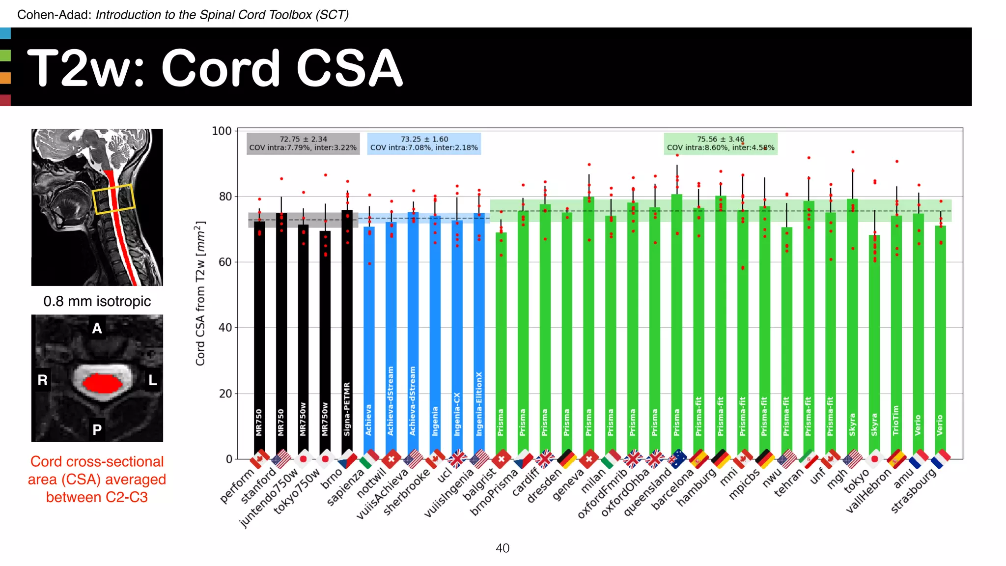 Cohen-Adad: Introduction to the Spinal Cord Toolbox (SCT)
T2w: Cord CSA
40
A
P
R L
0.8 mm isotropic
Cord cross-sectional
area (CSA) averaged
between C2-C3
 