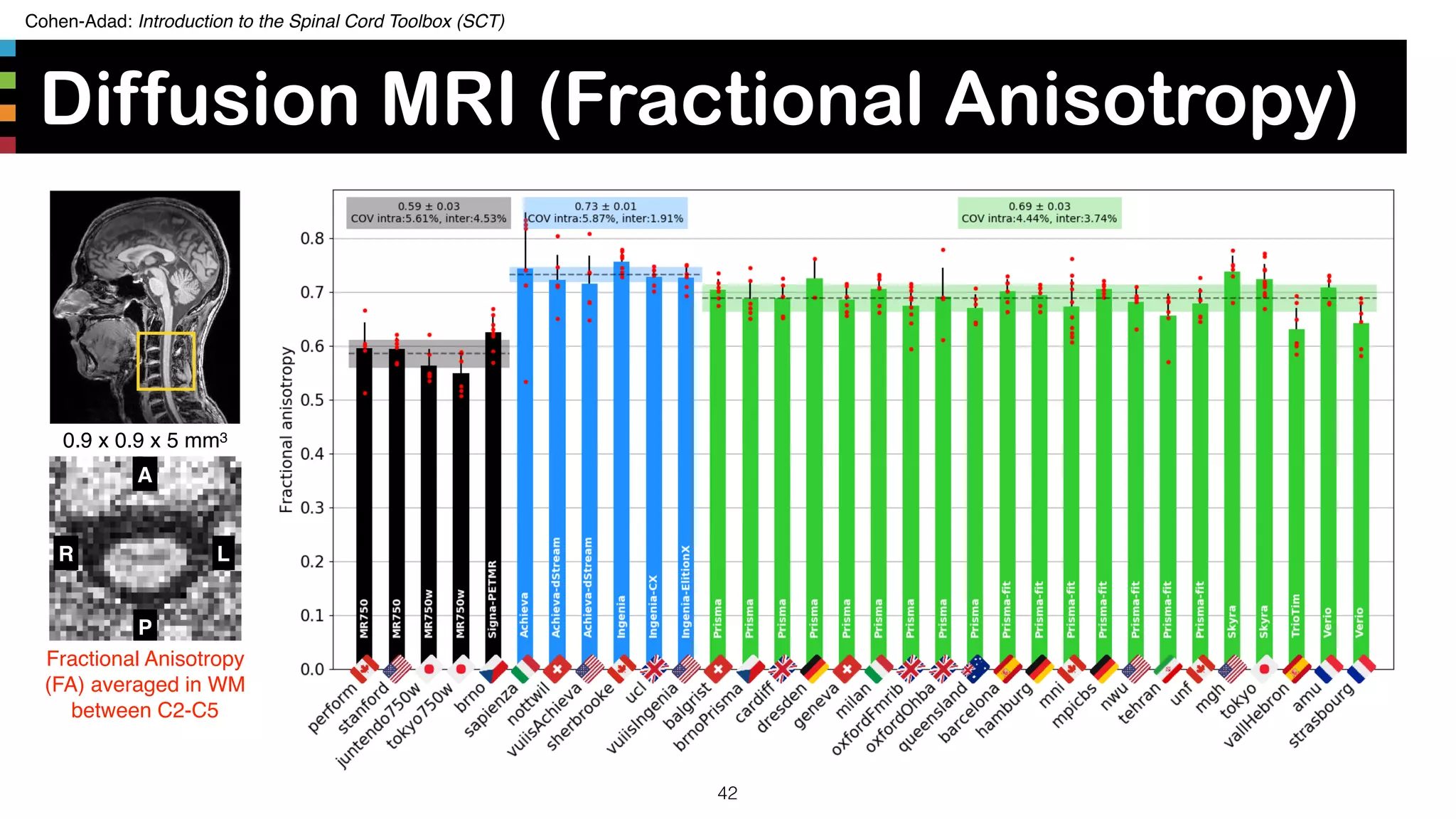 Cohen-Adad: Introduction to the Spinal Cord Toolbox (SCT)
Diffusion MRI (Fractional Anisotropy)
42
A
P
R L
0.9 x 0.9 x 5 mm3
Fractional Anisotropy
(FA) averaged in WM
between C2-C5
 