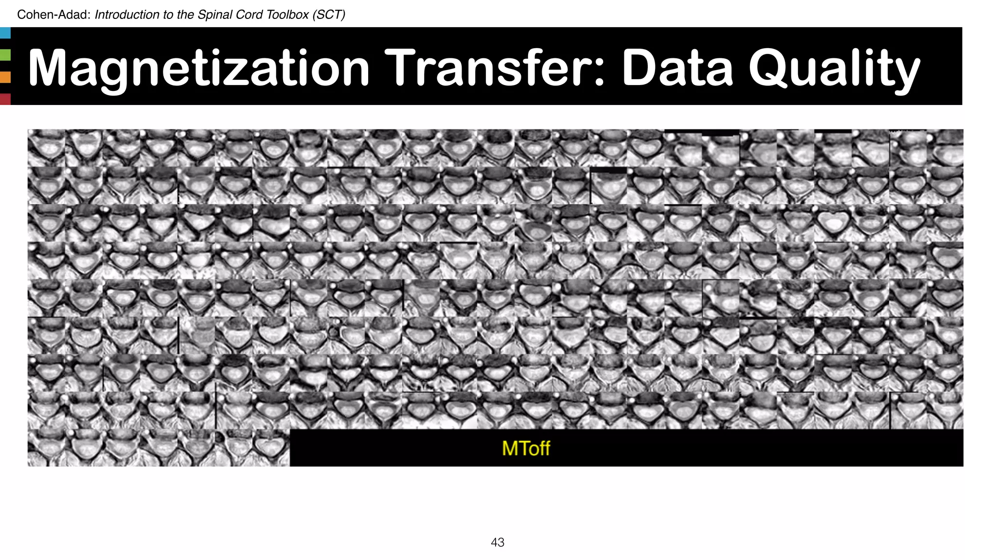 Cohen-Adad: Introduction to the Spinal Cord Toolbox (SCT)
Magnetization Transfer: Data Quality
43
 