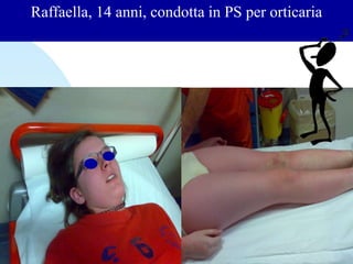 Raffaella, 14 anni, condotta in PS per orticaria
 
