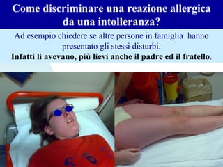 Come discriminare una reazione allergica
da una intolleranza?
Ad esempio chiedere se altre persone in famiglia hanno
presentato gli stessi disturbi.
Infatti li avevano, più lievi anche il padre ed il fratello.
 