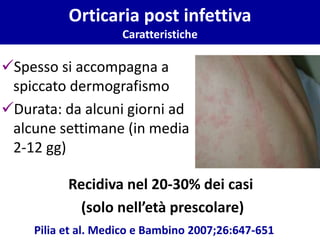 ✓Spesso si accompagna a
spiccato dermografismo
✓Durata: da alcuni giorni ad
alcune settimane (in media
2-12 gg)
Pilia et al. Medico e Bambino 2007;26:647-651
Recidiva nel 20-30% dei casi
(solo nell’età prescolare)
CaratteristicheOrticaria post infettiva
Caratteristiche
 