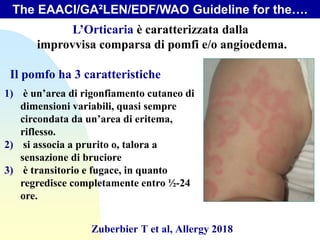 L’Orticaria è caratterizzata dalla
improvvisa comparsa di pomfi e/o angioedema.
Il pomfo ha 3 caratteristiche
1) è un’area di rigonfiamento cutaneo di
dimensioni variabili, quasi sempre
circondata da un’area di eritema,
riflesso.
2) si associa a prurito o, talora a
sensazione di bruciore
3) è transitorio e fugace, in quanto
regredisce completamente entro ½-24
ore.
The EAACI/GA²LEN/EDF/WAO Guideline for the….
Zuberbier T et al, Allergy 2018
 