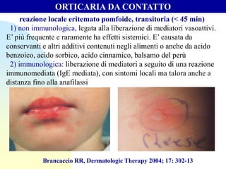 ORTICARIA DA CONTATTO
reazione locale eritemato pomfoide, transitoria (< 45 min)
1) non immunologica, legata alla liberazione di mediatori vasoattivi.
E’ più frequente e raramente ha effetti sistemici. E’ causata da
conservanti e altri additivi contenuti negli alimenti o anche da acido
benzoico, acido sorbico, acido cinnamico, balsamo del perù
2) immunologica: liberazione di mediatori a seguito di una reazione
immunomediata (IgE mediata), con sintomi locali ma talora anche a
distanza fino alla anafilassi
Brancaccio RR, Dermatologic Therapy 2004; 17: 302-13
 