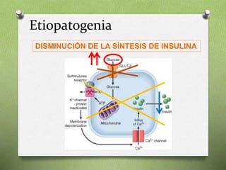 Etiopatogenia
DISMINUCIÓN DE LA SÍNTESIS DE INSULINA
 