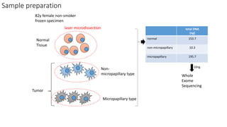 Tumor
Normal
Tissue
Micropapillary type
Non-
micropapillary type
laser microdissection
82y female non-smoker
frozen specimen
total DNA
(ng)
normal 153.7
non-micropapillary 10.3
micropapillary 195.7
Whole
Exome
Sequencing
10ng
Sample preparation
 