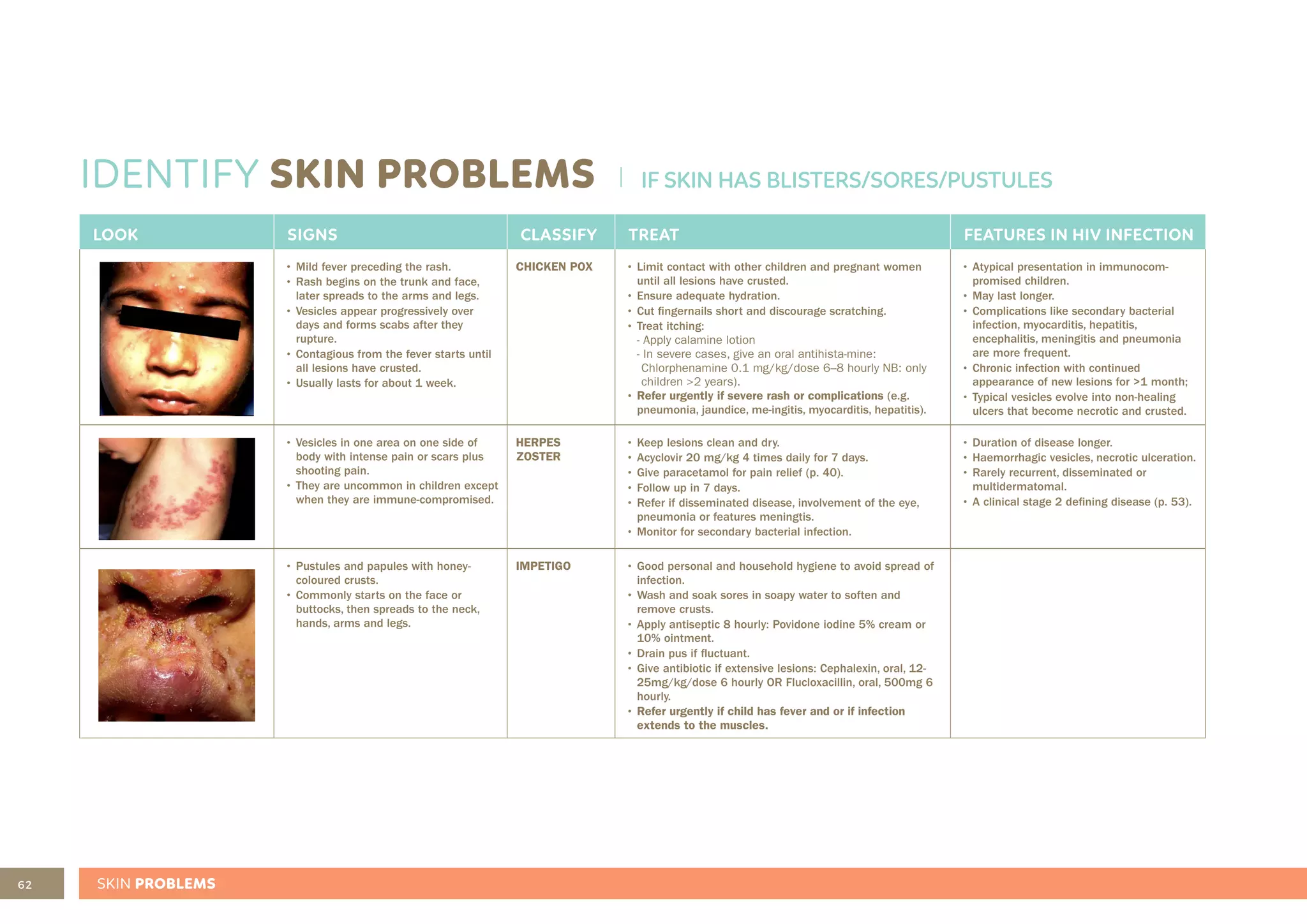 62 SKIN PROBLEMS
IDENTIFY SKIN PROBLEMS
LOOK SIGNS CLASSIFY TREAT FEATURES IN HIV INFECTION
• Mild fever preceding the rash.
• Rash begins on the trunk and face,
later spreads to the arms and legs.
• Vesicles appear progressively over
days and forms scabs after they
rupture.
• Contagious from the fever starts until
all lesions have crusted.
• Usually lasts for about 1 week.
CHICKEN POX • Limit contact with other children and pregnant women
until all lesions have crusted.
• Ensure adequate hydration.
• Cut fingernails short and discourage scratching.
• Treat itching:
- Apply calamine lotion
- In severe cases, give an oral antihista-mine:
Chlorphenamine 0.1 mg/kg/dose 6–8 hourly NB: only
children >2 years).
• Refer urgently if severe rash or complications (e.g.
pneumonia, jaundice, me-ingitis, myocarditis, hepatitis).
• Atypical presentation in immunocom-
promised children.
• May last longer.
• Complications like secondary bacterial
infection, myocarditis, hepatitis,
encephalitis, meningitis and pneumonia
are more frequent.
• Chronic infection with continued
appearance of new lesions for >1 month;
• Typical vesicles evolve into non-healing
ulcers that become necrotic and crusted.
• Vesicles in one area on one side of
body with intense pain or scars plus
shooting pain.
• They are uncommon in children except
when they are immune-compromised.
HERPES
ZOSTER
• Keep lesions clean and dry.
• Acyclovir 20 mg/kg 4 times daily for 7 days.
• Give paracetamol for pain relief (p. 40).
• Follow up in 7 days.
• Refer if disseminated disease, involvement of the eye,
pneumonia or features meningtis.
• Monitor for secondary bacterial infection.
• Duration of disease longer.
• Haemorrhagic vesicles, necrotic ulceration.
• Rarely recurrent, disseminated or
multidermatomal.
• A clinical stage 2 defining disease (p. 53).
• Pustules and papules with honey-
coloured crusts.
• Commonly starts on the face or
buttocks, then spreads to the neck,
hands, arms and legs.
IMPETIGO • Good personal and household hygiene to avoid spread of
infection.
• Wash and soak sores in soapy water to soften and
remove crusts.
• Apply antiseptic 8 hourly: Povidone iodine 5% cream or
10% ointment.
• Drain pus if fluctuant.
• Give antibiotic if extensive lesions: Cephalexin, oral, 12-
25mg/kg/dose 6 hourly OR Flucloxacillin, oral, 500mg 6
hourly.
• Refer urgently if child has fever and or if infection
extends to the muscles.
IF SKIN HAS BLISTERS/SORES/PUSTULES
 