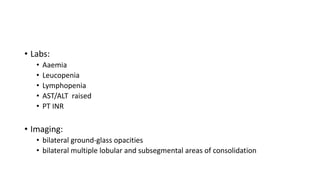 • Labs:
• Aaemia
• Leucopenia
• Lymphopenia
• AST/ALT raised
• PT INR
• Imaging:
• bilateral ground-glass opacities
• bilateral multiple lobular and subsegmental areas of consolidation
 