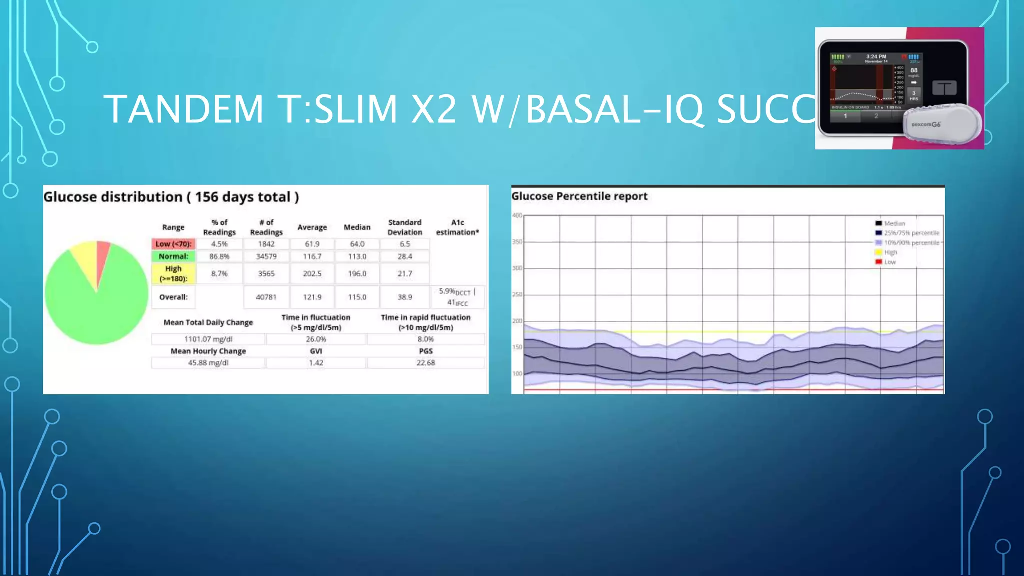 TANDEM T:SLIM X2 W/BASAL-IQ SUCCESS
 