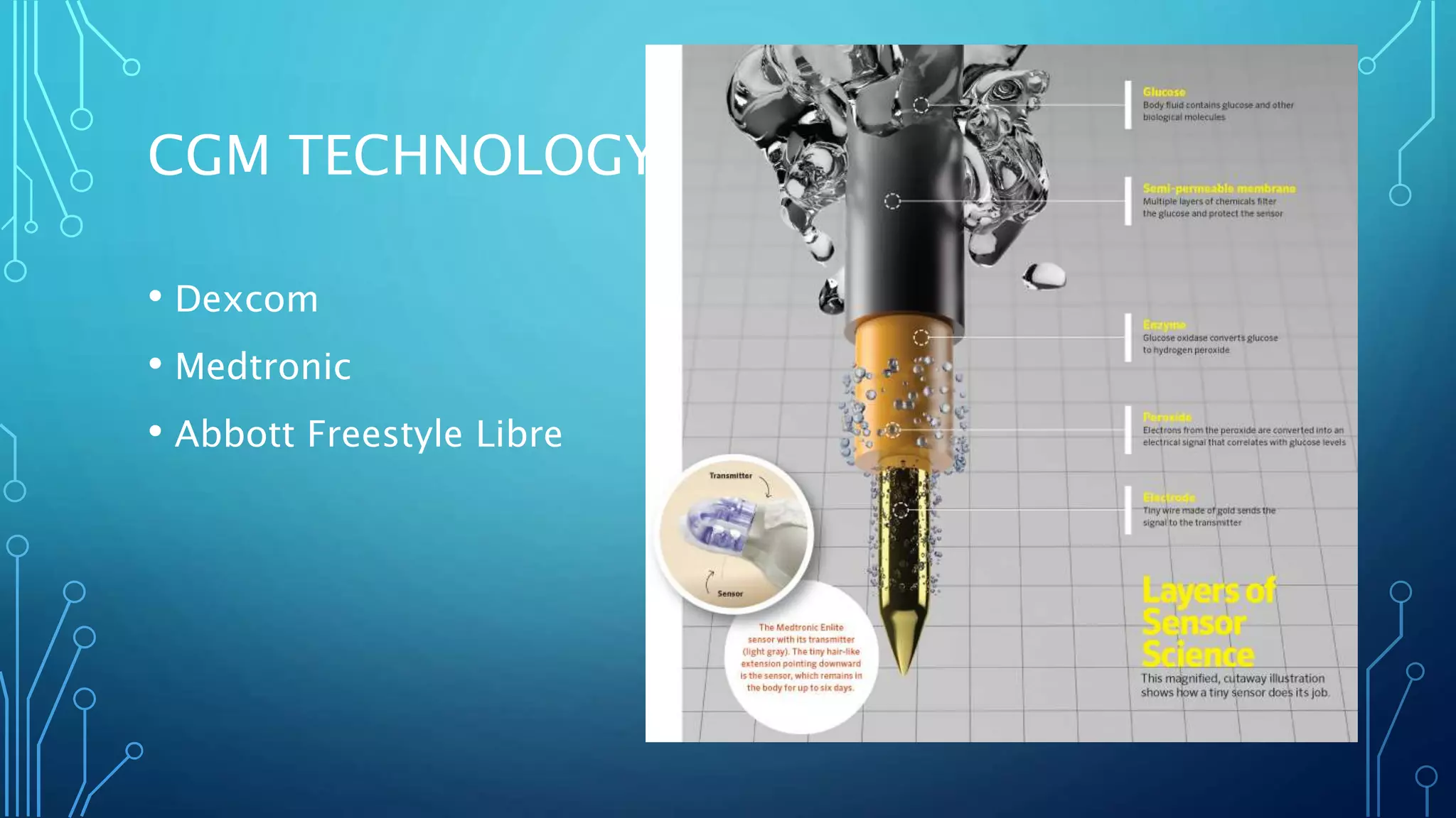 CGM TECHNOLOGY
• Dexcom
• Medtronic
• Abbott Freestyle Libre
 