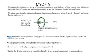 MYOPIA
Myopia or shortsightednes is a type of refractive error in which parallel rays of light coming from infinity are
focused in front of retina when accommodation being at rest that is image is formed infront of retina
Myopia or near-sightedness (short-sightedness) is one form of ametropia where the eye is effectively too long or
has too high a power.
•Nearsightedness: Nearsightedness, or myopia, is a condition in which nearby objects are seen clearly, but
distant ones are blurred.
• Nearsightedness can be inherited and is often discovered during childhood.
• However, you can develop nearsightedness in early adulthood.
• People that develop myopia in early adulthood usually do not develop high amounts of nearsightedness.
Parallel rays of
light coming
from infinity
Retina
Image is formed infront of
retina
 