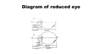 Diagram of reduced eye
 