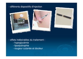 - différents dispositifs d'injection
- effets indésirables du traitement :
- hypoglycémie
- lipodystrophie
- rougeur cutanée et douleur
 