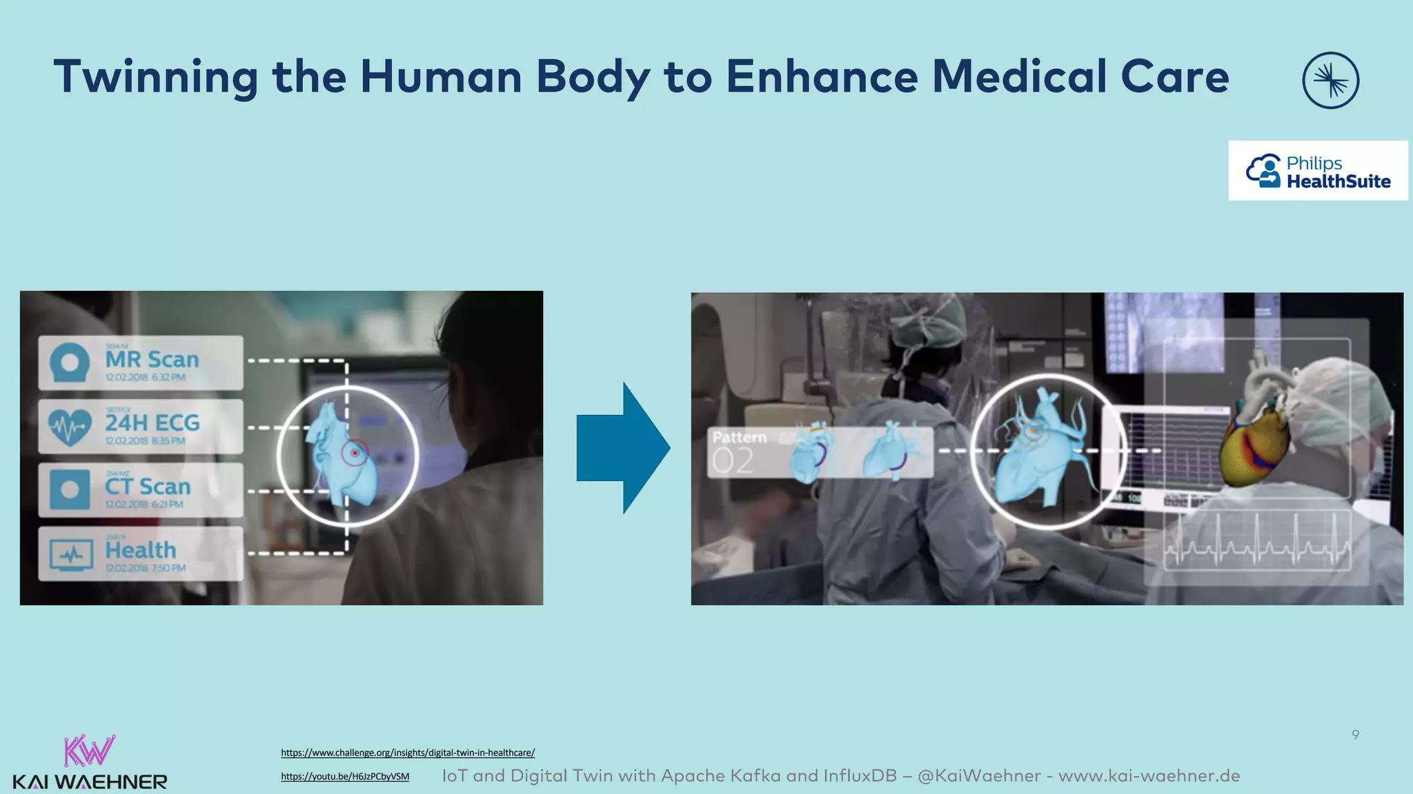 IoT and Digital Twin with Apache Kafka and InfluxDB – @KaiWaehner - www.kai-waehner.de
Twinning the Human Body to Enhance Medical Care
9
https://www.challenge.org/insights/digital-twin-in-healthcare/
https://youtu.be/H6JzPCbyVSM
 