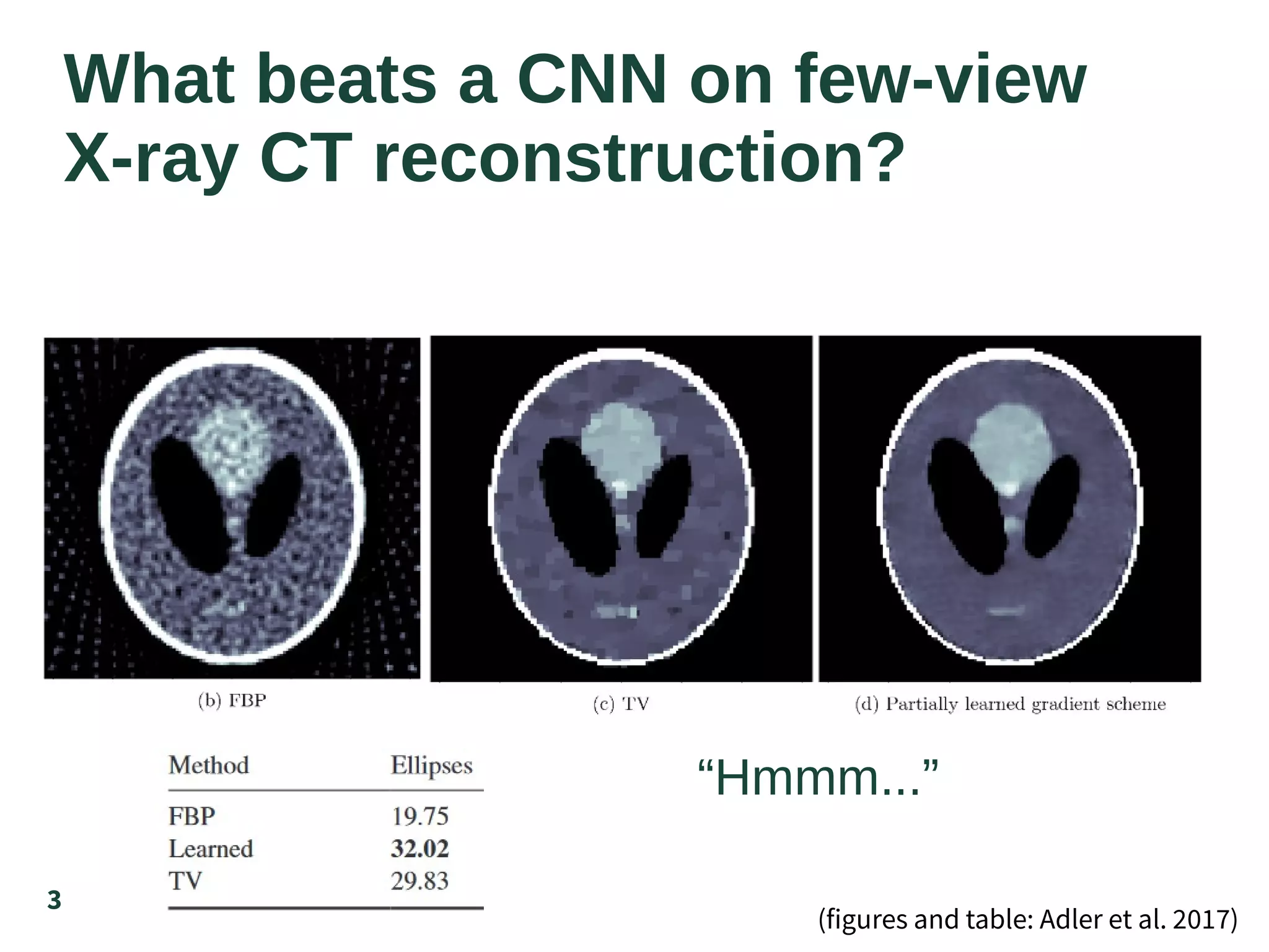 3
What beats a CNN on few-view
X-ray CT reconstruction?
(figures and table: Adler et al. 2017)
“Hmmm...”
 