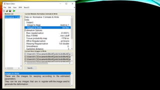 FMRI_DATA_ANALYSIS_REPORT_AND_PREPROCESSING_STEPS .pptx