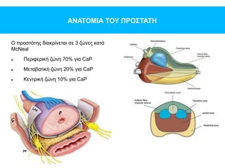 ΑΝΑΤΟΜΙΑ ΤΟΥ ΠΡΟΣΤΑΤΗ
Ο προστάτης διακρίνεται σε 3 ζώνες κατά
McNeal
 Περιφερική ζώνη 70% για CaP
 Μεταβατική ζώνη 20% για CaP
 Κεντρική ζώνη 10% για CaP
 